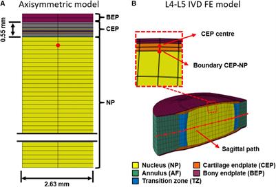 Theoretical Explorations Generate New Hypotheses About the Role of the Cartilage Endplate in Early Intervertebral Disk Degeneration